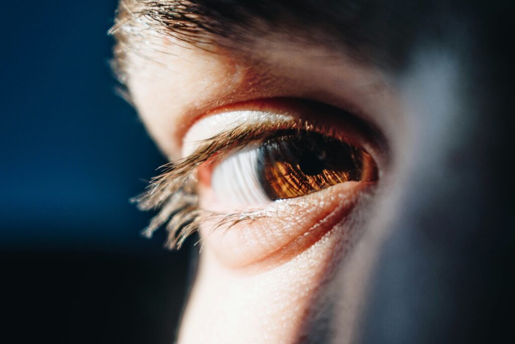 12 Best Dark Circle Treatment for Your Eyes (According to Experts)