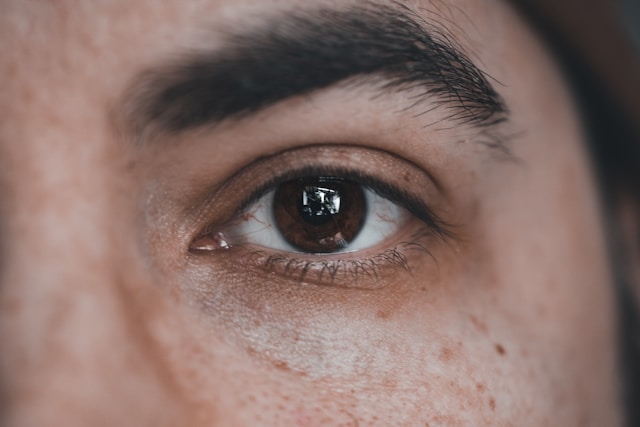Dark Circle Treatment ROI Singapore: Is It Worth It
