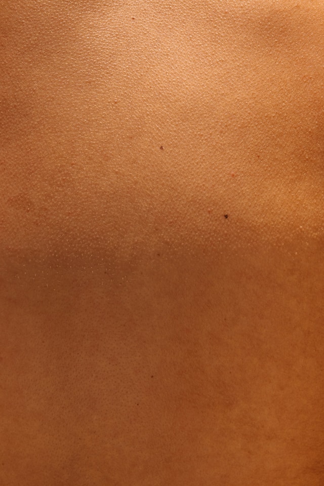 Skin Boosters Why Everyone Suddenly Wants This Glow-Up Treatment